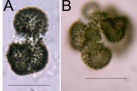 Image result for Microcoelia nyungwensis