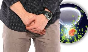 Prostate cancer is a cancer which develops from cells in the prostate. Prostate Cancer Symptoms The Sexual Sign You Should Never Ignore Are You At Risk Sound Health And Lasting Wealth