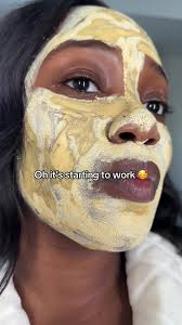 Seeing results #pimple #acne #results