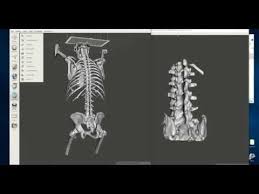 Advanced Free 3d Printable Bone Creation Creating And Processing Multiple Models From A Ct Scan Youtube Ct Scan 3d Printing Printables