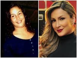 Naiara azevedo mostrou o antes e depois de transformação no rosto ao colocar preenchimento labial. Antes E Depois Das Famosas Vieiramayara