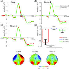 On the same side, with reference to a given point, e.g., a dilated pupil on the same side as an extradural hematoma. The N2pc Waveforms A B C For Contralateral And Ipsilateral Download Scientific Diagram