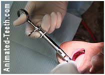 Vasodilators are injected into the same area as the local anaesthesia after the dental procedure is over. Will Your Dental Injection Hurt Factors Why Preventing Painful Shots