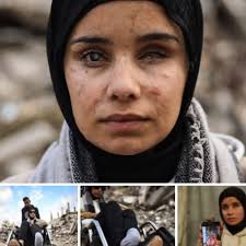 Six-year-old Huda Abu Al-Naja has died after being denied evacuation from  Gaza for treatment. Suffering from severe malnutrition, Huda's family spent  their final days asking when she would be allowed to travel