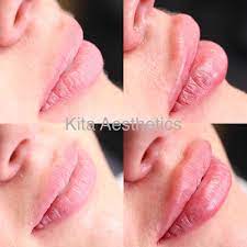 Croma princess 6ml package £350. Kita Aesthetics Kitaaesthetics Twitter