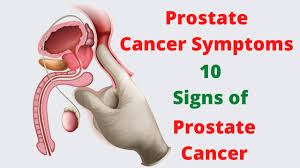 Check spelling or type a new query. Prostate Cancer Symptoms 10 Signs Of Prostate Cancer Youtube