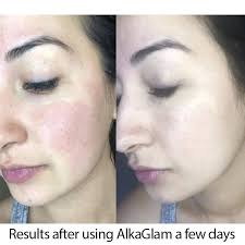 Face-redness_600x600_3_600x600.jpg?v=1590173529