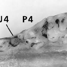 Image result for Helichrysum whyteanum