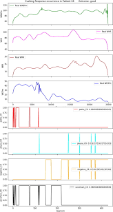 Image result for Cushing Response