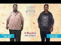 Pin On Bariatric Surgery India Punjab
