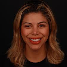 Mauro Castaño (@maoperfectsmile) · Instagram 照片和Reels