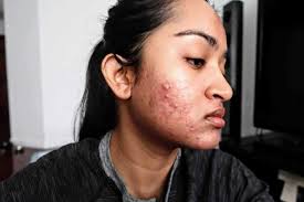 I couldn't hide the huge bumps