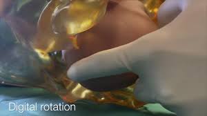 Image result for Manual Rotation in Occipitoposterior Presentation