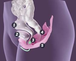 Elvie Trainer pelvic floor exerciserの画像