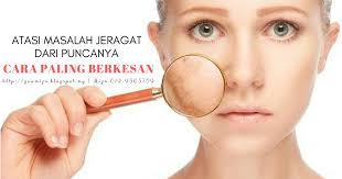 Yang ini pun ada 2 cara anda boleh pilih sama ada ikut cara tradisional atau moden. Punca Jeragat Degil Yang Anda Wajib Tahu Dan Cara Atasinya Dengan Berkesan Amizah Azid