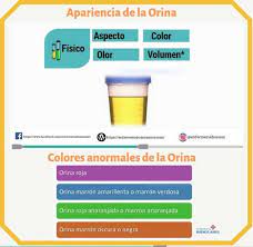 Uroanalisis Enfermeria Laboratorio Orina Marron Anaranjado Orina Enfermeria