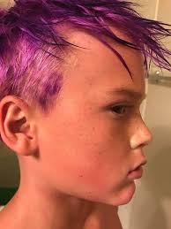 How do you get hair dye off your skin?