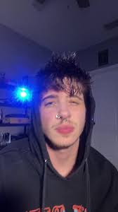 Me Covering My Face When I Saw Serrano's Eyelid Hanging During The Fight