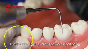 Maybe you would like to learn more about one of these? How To Use The Ultrasonic Scaler Tips Youtube
