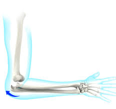 Image result for Elbow Dislocation