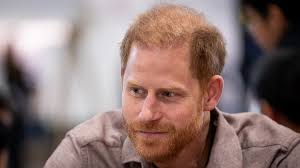Prince Harry Hair Transplant Rumors ...