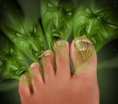 Smelly Feet In Summer Causes Home Remedies And Prevention