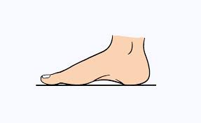 Tulang kaki kanan sering ngilu. Nyeri Pada Punggung Kaki Kanan Apa Penyebabnya Klinik Patella