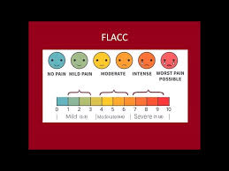 Image result for FLACC Scale