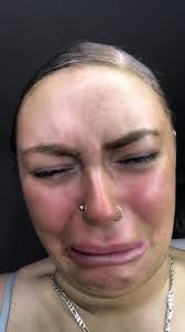 Handling Mistakes and Moving Forward