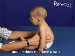 6 Month Olds Babies In Sitting Typical And Atypical Development Comparison Youtube