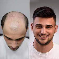 The hair weaving men can be weaved, clipped, braided, or bonded to create the desired hairstyle. Top 100 Hair Stylist In Jodhpur Best Hair Salons Justdial