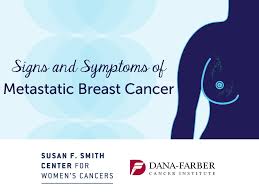 Some common signs of metastatic cancer include: Dana Farber On Twitter What Are The Symptoms Of Metastatic Breast Cancer Learn More On The Blog Https T Co Vdsgj7v2zb Bcsm