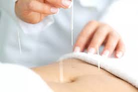 Acupuncture & Fertility - New Hope Fertility Center