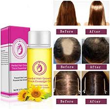 The only way to truely prevent hair loss is a hair transplant. Bsmean 20ml Hair Serum Hair Growth Serum Hair Growth Oil For Thinning Hair Anti Hair Loss Serum Promote Hair Growth Strengthen Hair Roots Thickening Regrowth Product For Men Women Amazon Co Uk Beauty