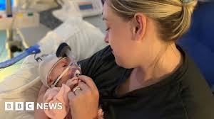 Sterilised mum: My miracle baby stopped breathing three times