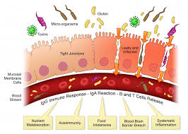 Dott Francesco Pepino Biologo Nutrizionistamalattie Autoimmuni Dott Francesco Pepino Biologo Nutrizionista