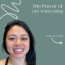 Michelle is Feelin’ GLO-rious this summer ☀️🦷 , Bright smiles & beach  vibes thanks to GLO Science! , Tan lines fade, but this GLO stays! 💋Book  your teeth whitening today:, 🔗 Link in Bio, ☎️ (858) ...
