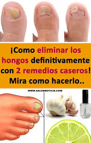 Hongos En Las Uñas De Las Manos Como Eliminarlos Como Eliminar Los Hongos Definitivamente Con 2 Remedios Caseros Mira Como Hacerlo Remedios Caseros Naturales Toenail Removal Toe Nails Diy Beauty Hacks