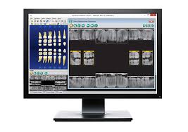 Dentrix Practice Management Dexis Digital Imaging