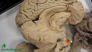 Image result for Amnesic Shellfish Poisoning