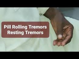 Image result for Rest Tremor