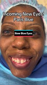 She wanted a more subtle appearance (low intensity) of Paris Blue.  Intensity level is personal preference. Our signature ColorEyes procedure  is not an iris implant