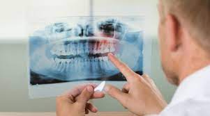 Oral Diagnostic Sciences - School Of Dental Medicine - University At Buffalo
