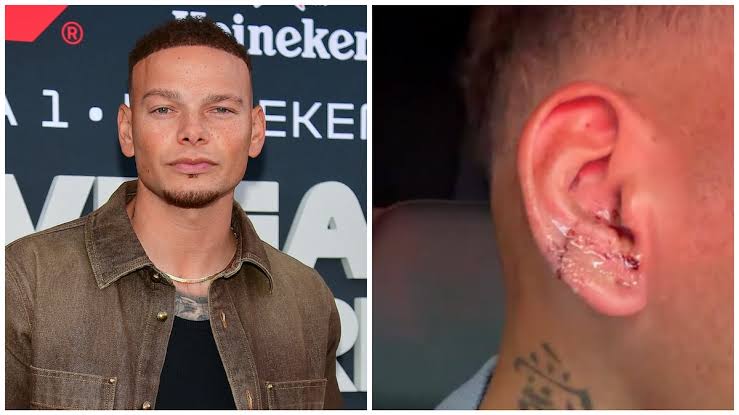 Country Star Kane Brown Gets 23 Stitches After Gruesome Golf Injury