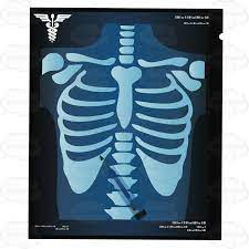 X Ray Of A Chest With A Pencil On The X Ray X Ray Cartoon Clip Art Vector Illustration