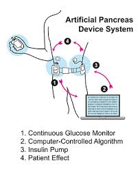 What can type 1 diabetics eat. Type 1 Diabetes Niddk