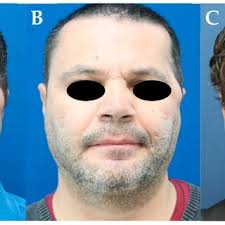 Daniel Schmauss's research works