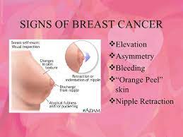Breast cancer accounts for 25% to 32% of all female cancers in all the major cities in india. Breast Self Examination
