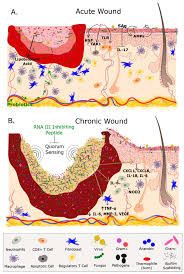 Wound care center texas vista medical center 7400 barlite blvd. Ijms Free Full Text The Cutaneous Microbiome And Wounds New Molecular Targets To Promote Wound Healing Html
