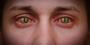 The primary downside to these contact lenses is their lack of ultraviolet light protection as compared to some of the other offerings from alcon and from other brands. Here S Why You Should Never Use Decorative Contact Lenses In Graphic Pictures Ars Technica